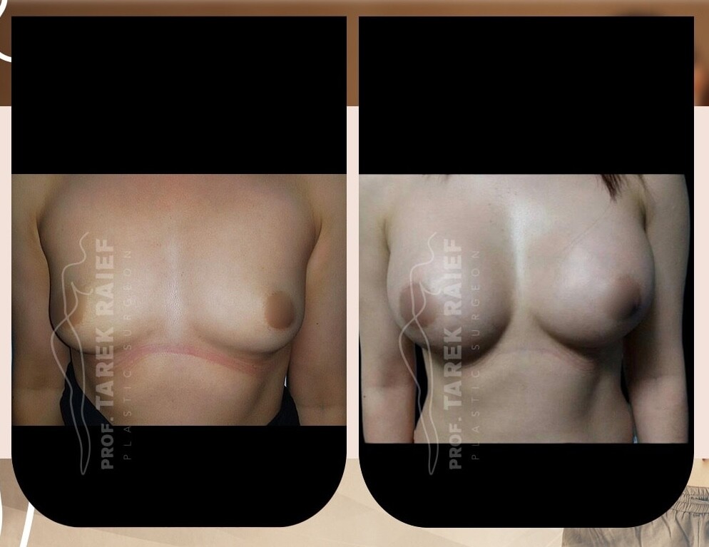 Clinic Results Gallery